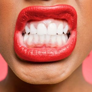 Zaciskanie zębów – przyczyny, skutki i leczenie zaciskania szczęki