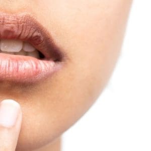Suchość w ustach – co znaczy i jak ją zwalczyć?