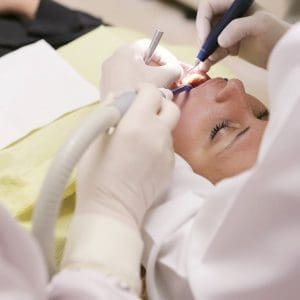 Fleczer dentystyczny – czym jest, jak długo można go nosić i co robić, gdy wypadnie?